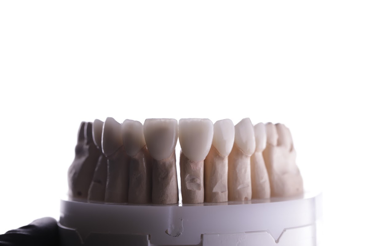 Pleasant Valley Family and Cosmetic Dentistry photo 3