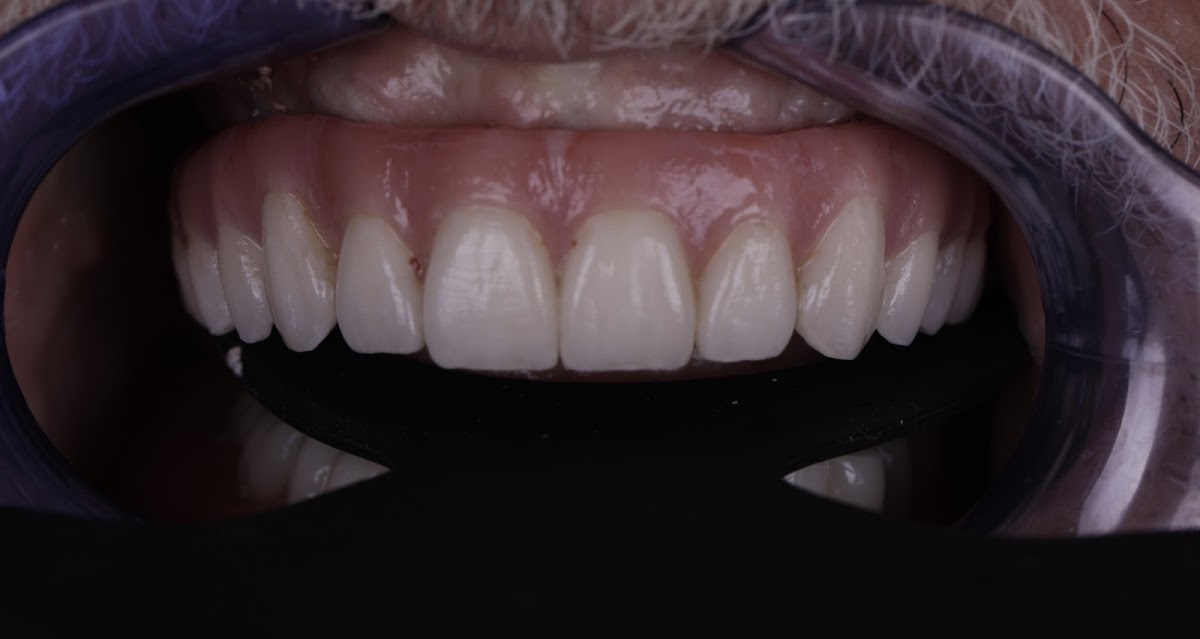 Pleasant Valley Family and Cosmetic Dentistry photo 4