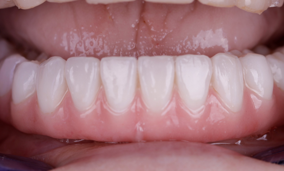Pleasant Valley Family and Cosmetic Dentistry photo 5
