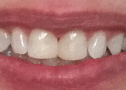 East Burn Dentistry - Portland Dentist photo 2