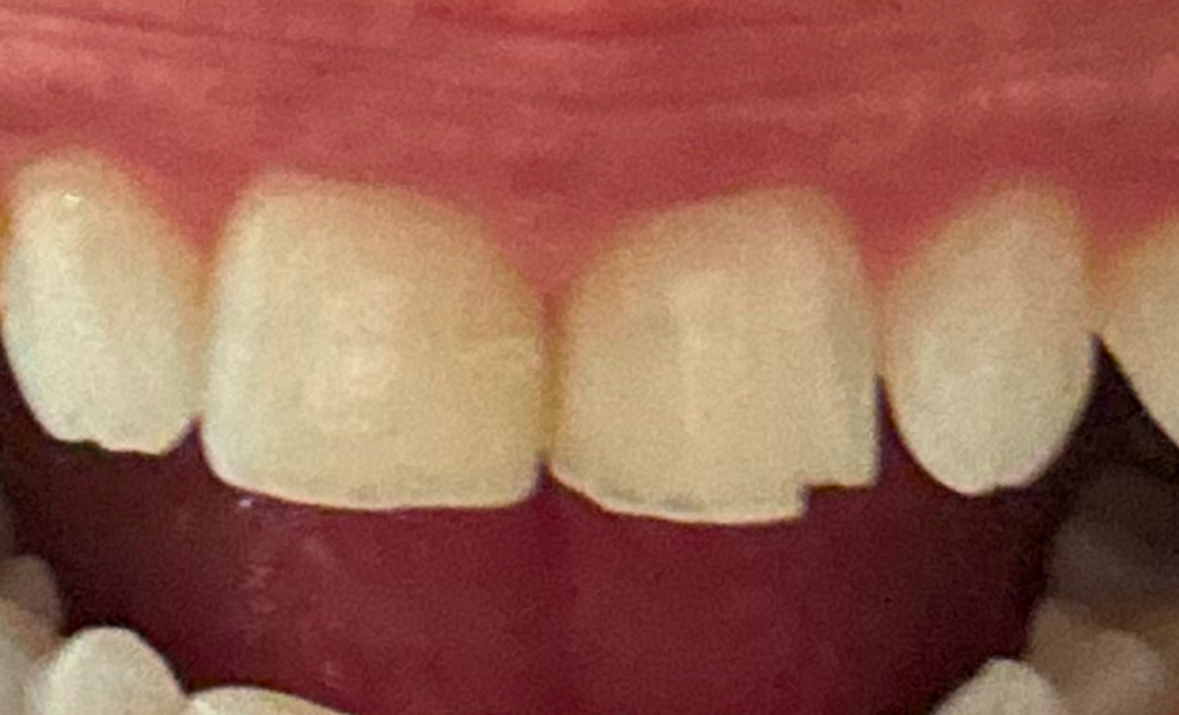 East Burn Dentistry - Portland Dentist photo 5