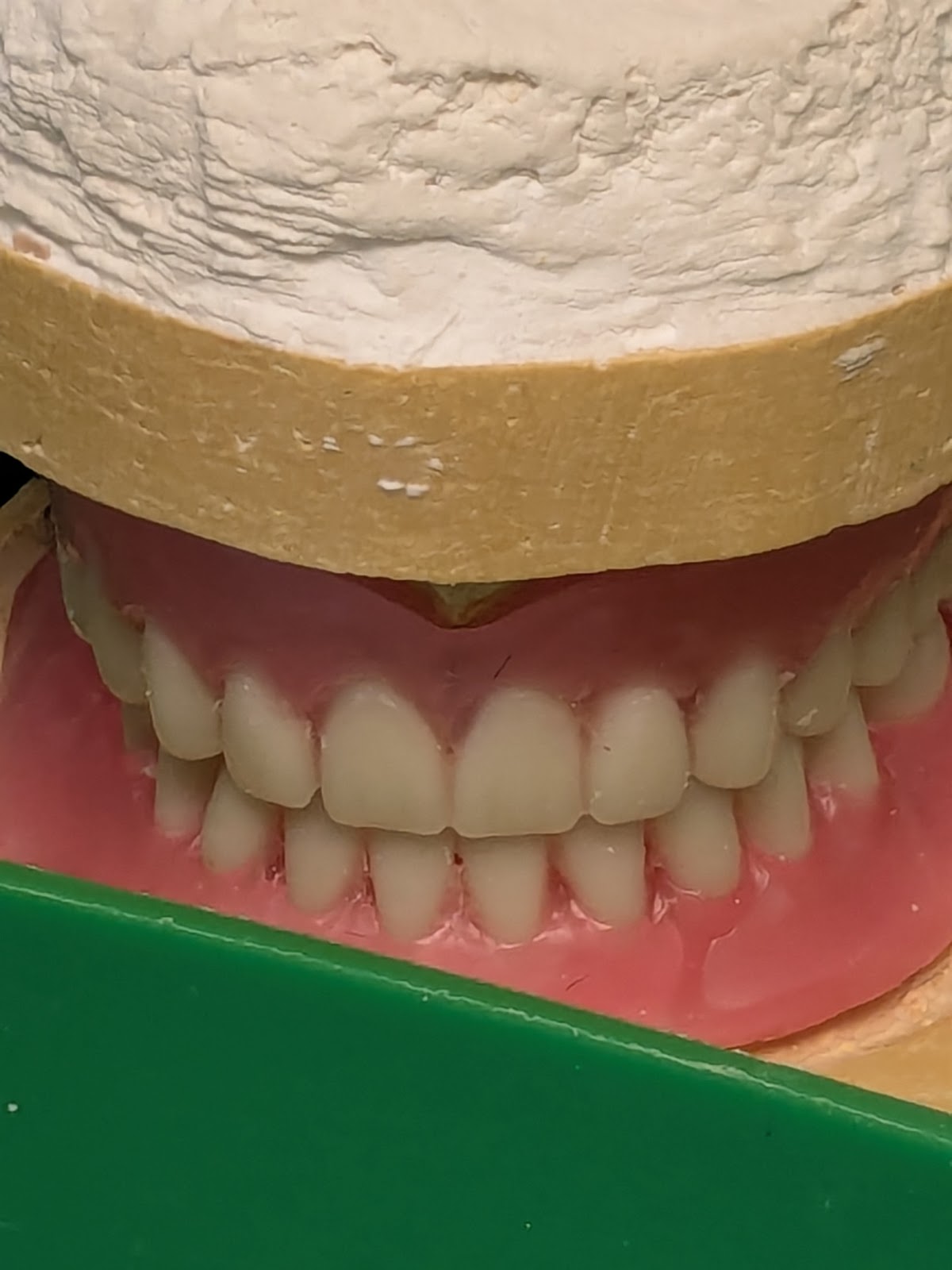 Affordable Dentures & Implants - Lima photo 2