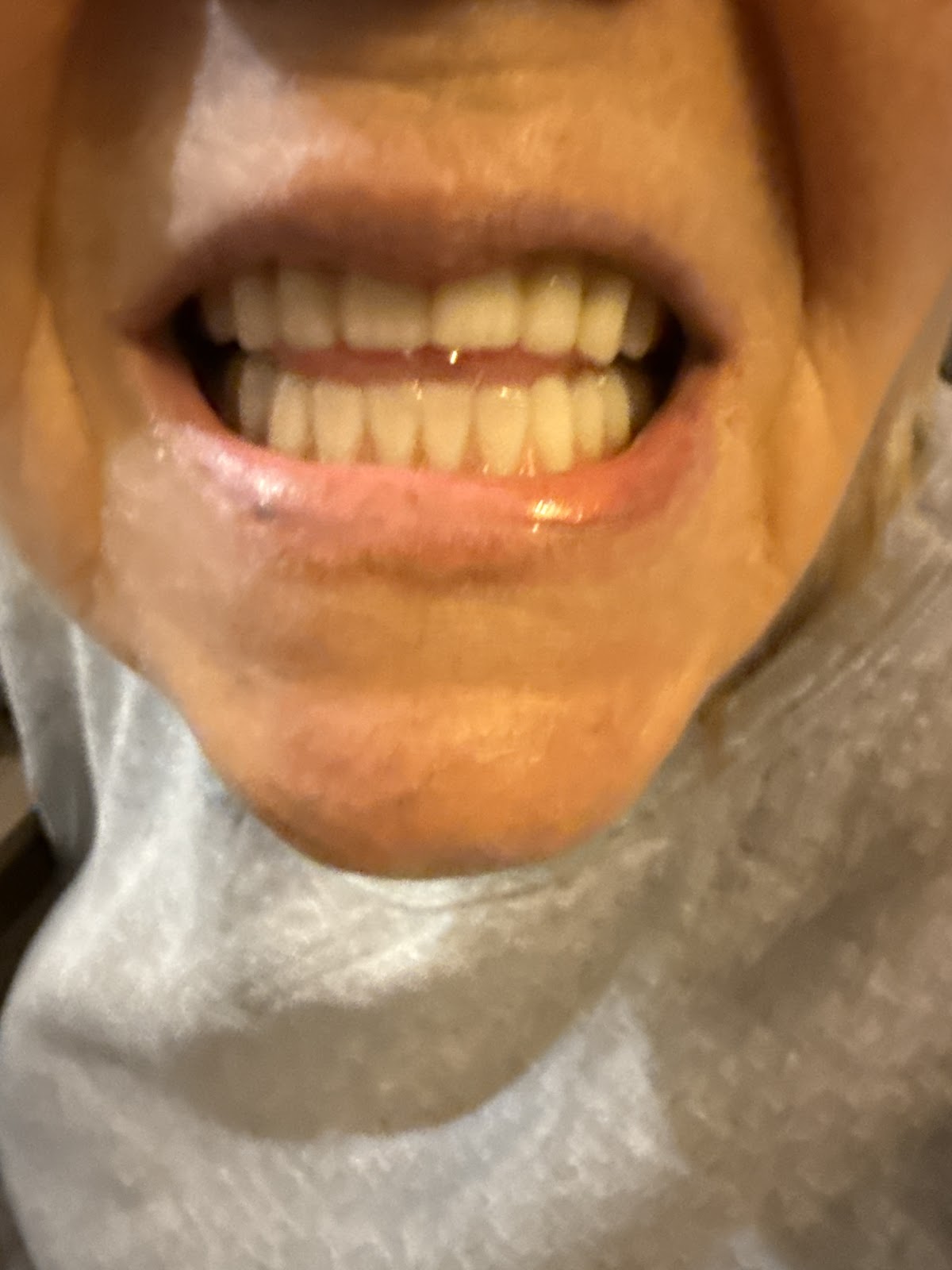 Aspen Dental - Norridge photo 4