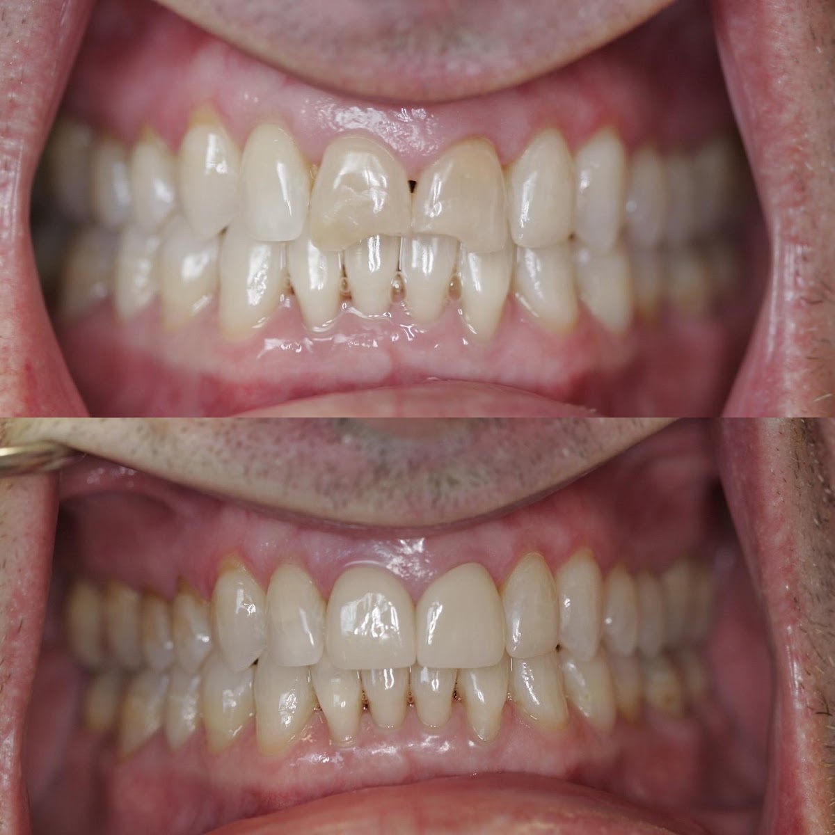 Advanced Dental Care - Tacoma photo 3
