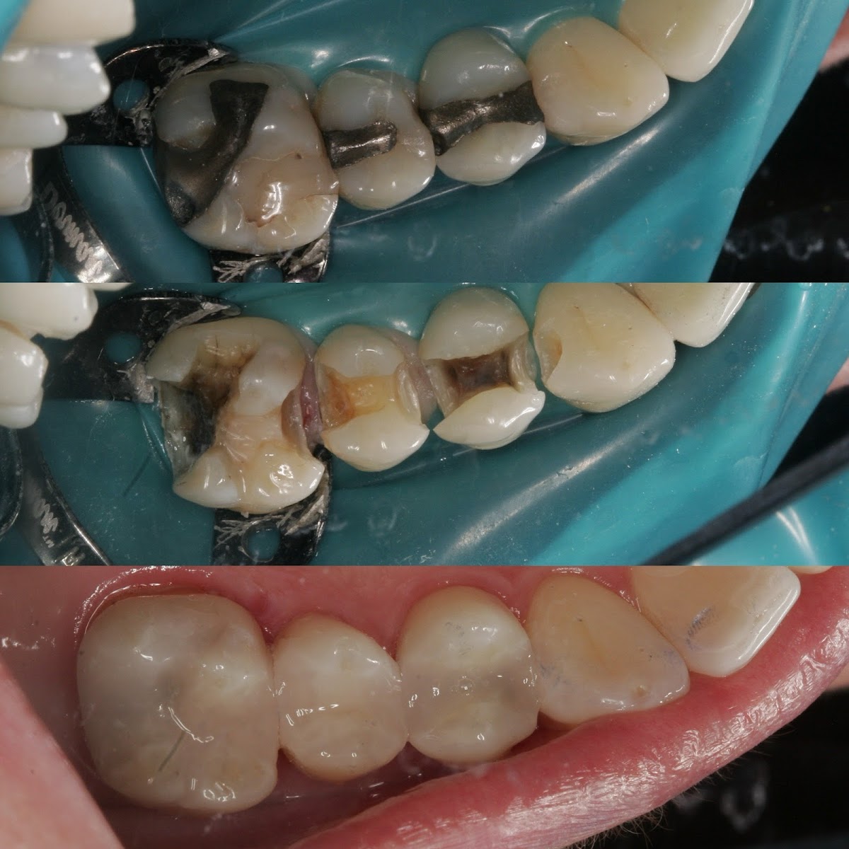 Advanced Dental Care - Tacoma photo 6