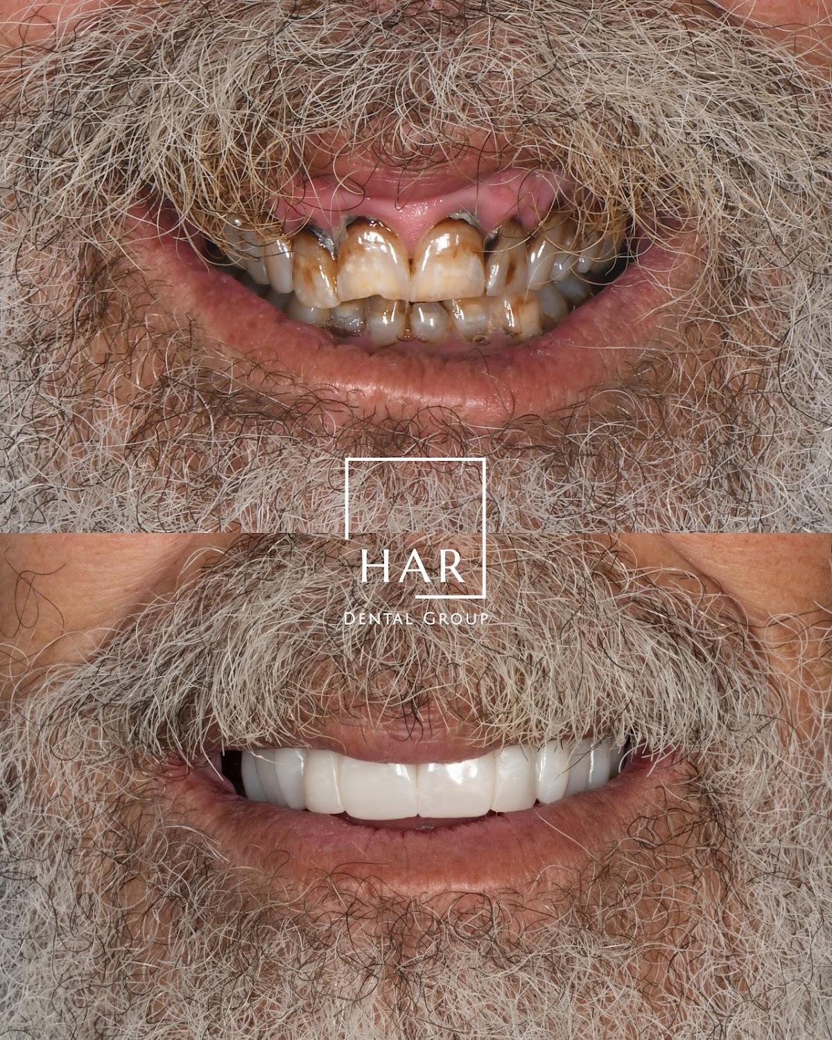 Amarillo Dental & Implant Center- Har Dental photo 2