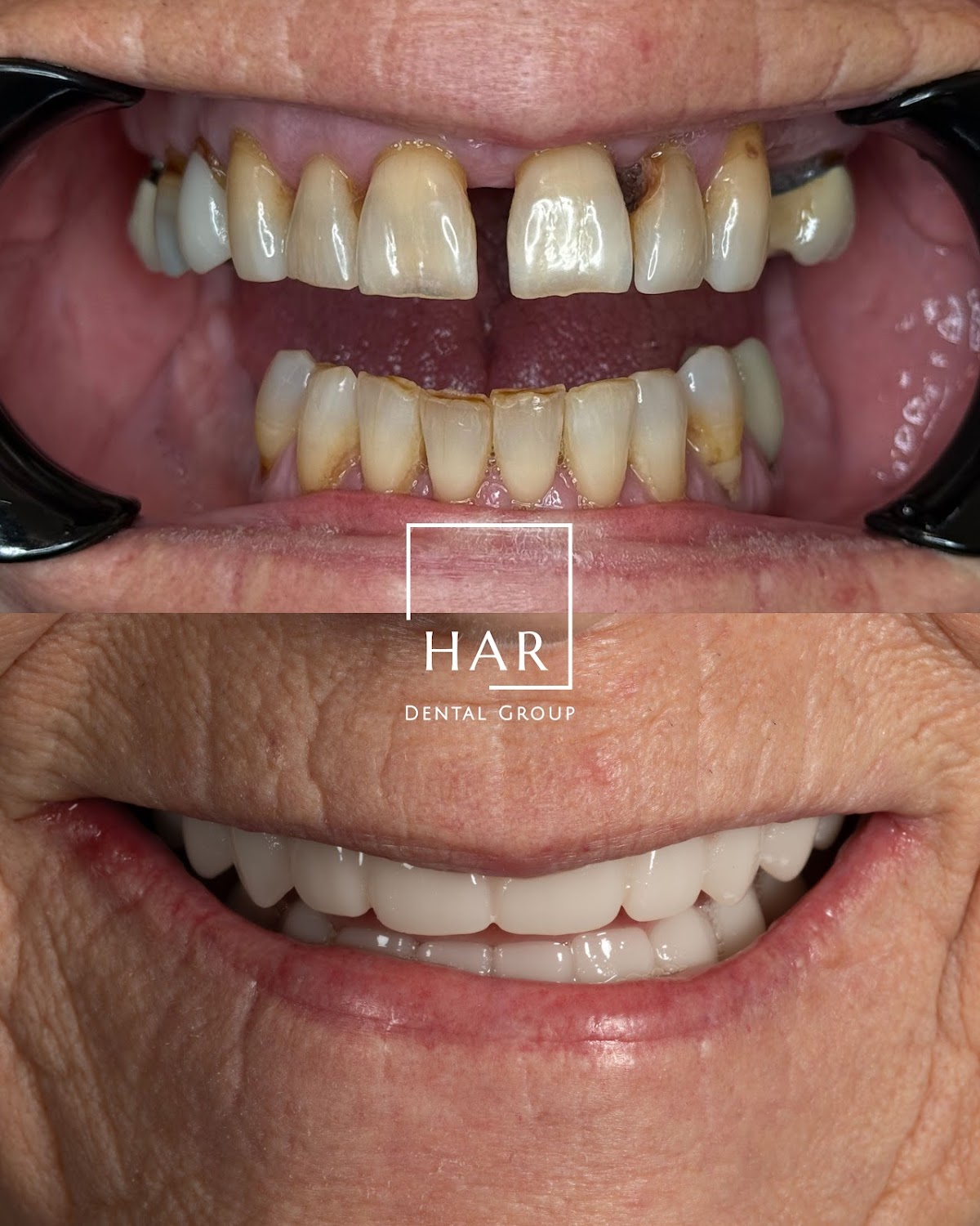 Amarillo Dental & Implant Center- Har Dental photo 3