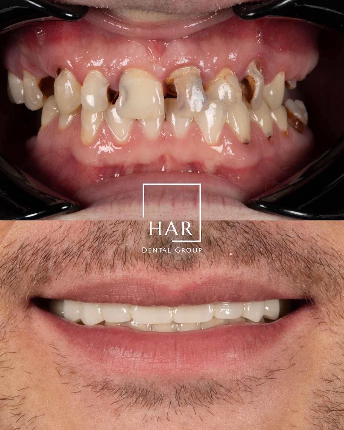 Amarillo Dental & Implant Center- Har Dental photo 4