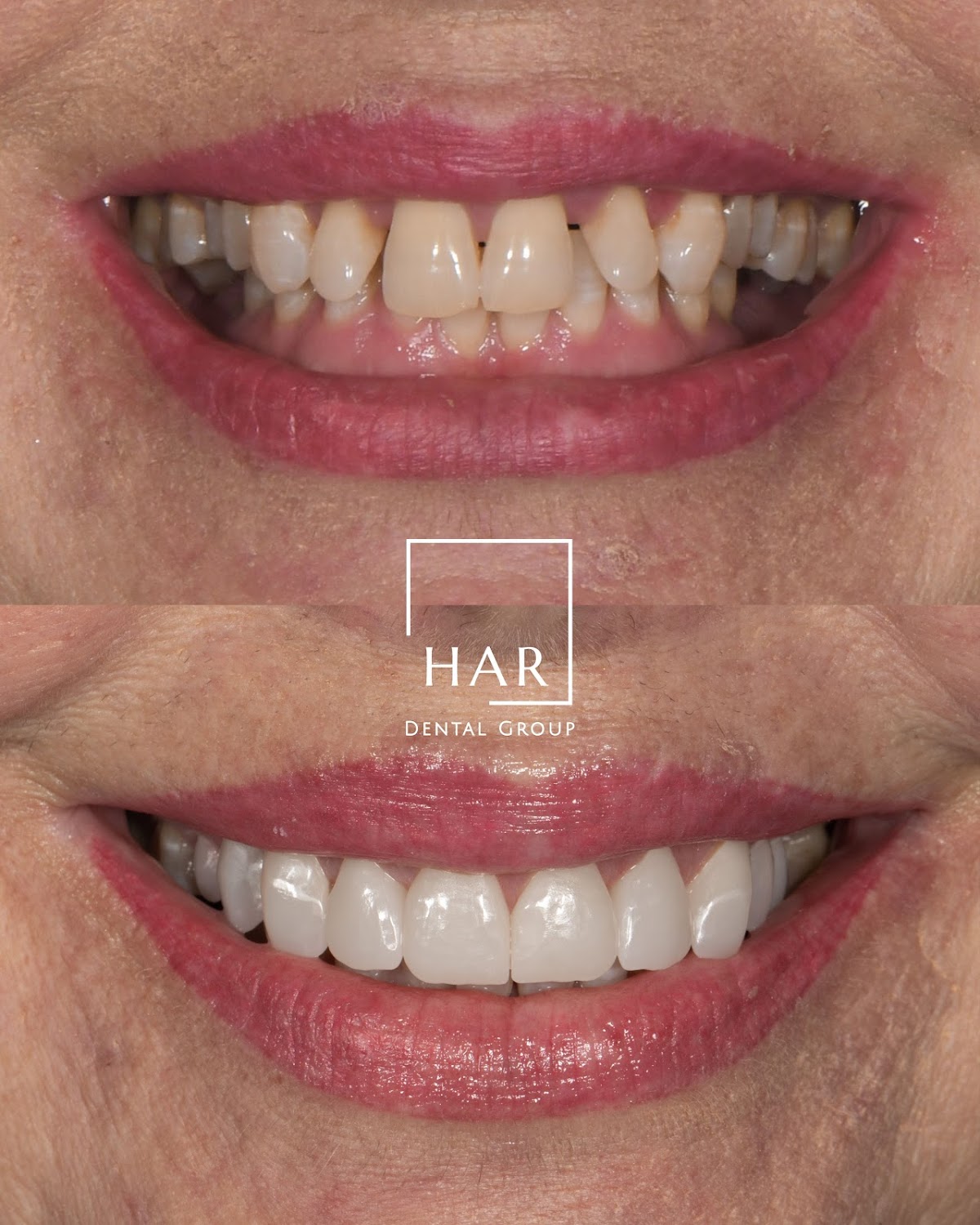 Amarillo Dental & Implant Center- Har Dental photo 5