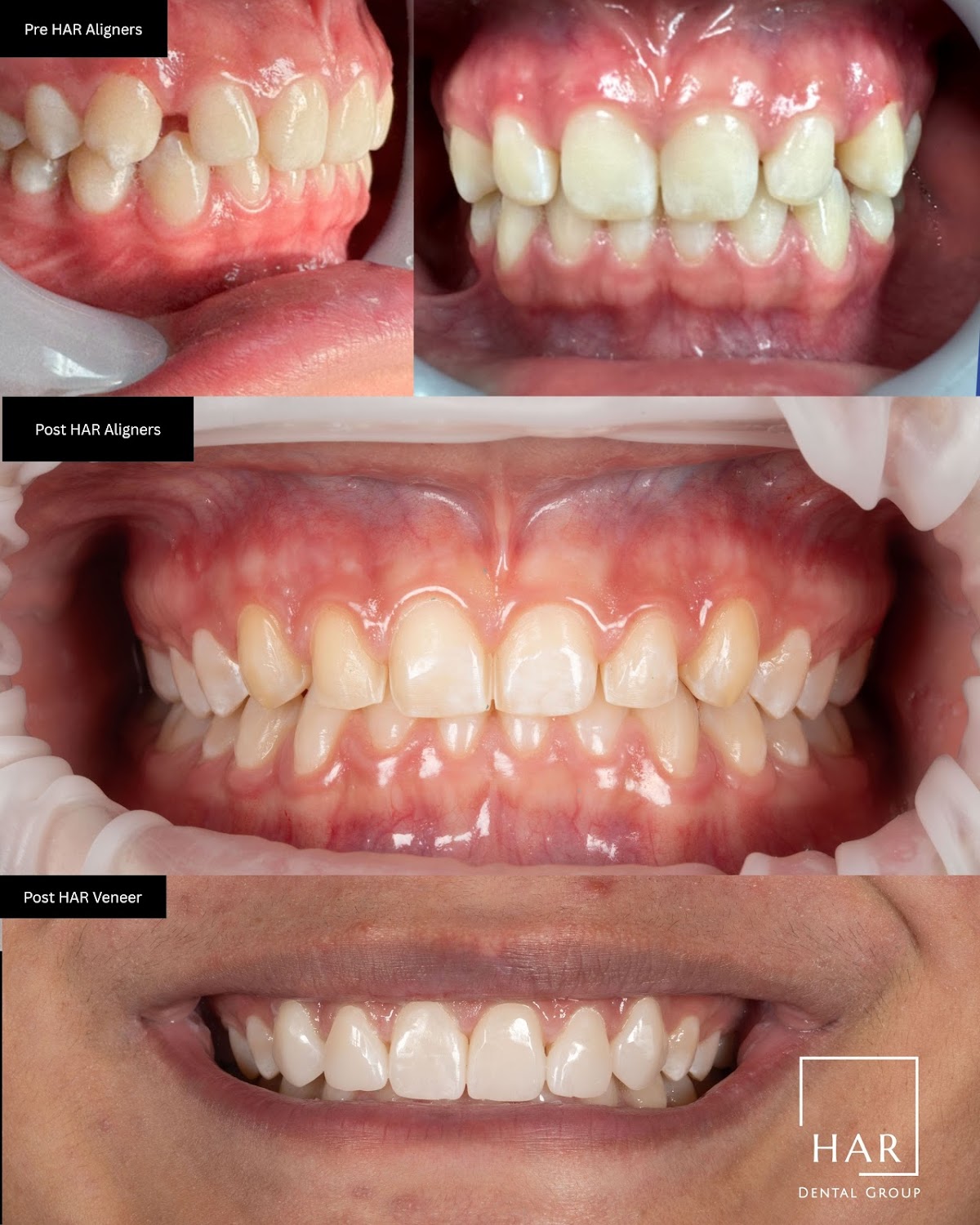 Amarillo Dental & Implant Center- Har Dental photo 6