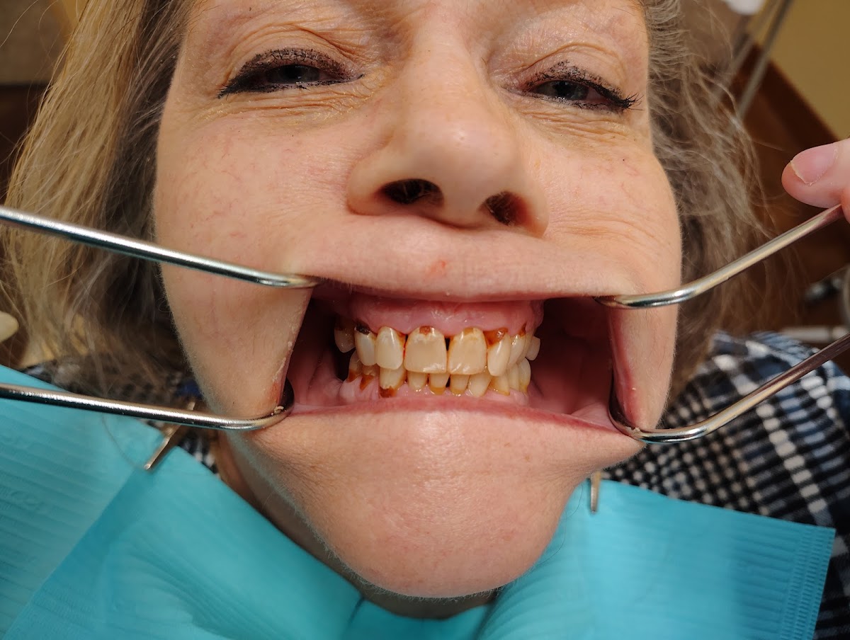 Anderson Dental photo 5