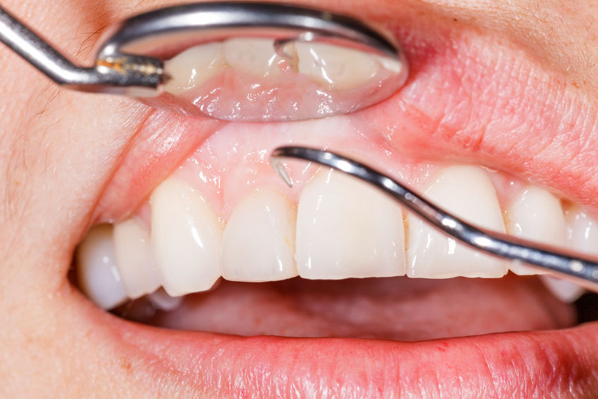 Precision Oral Surgery and Implants photo 2