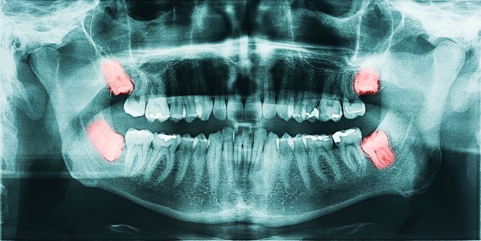 Precision Oral Surgery and Implants photo 3