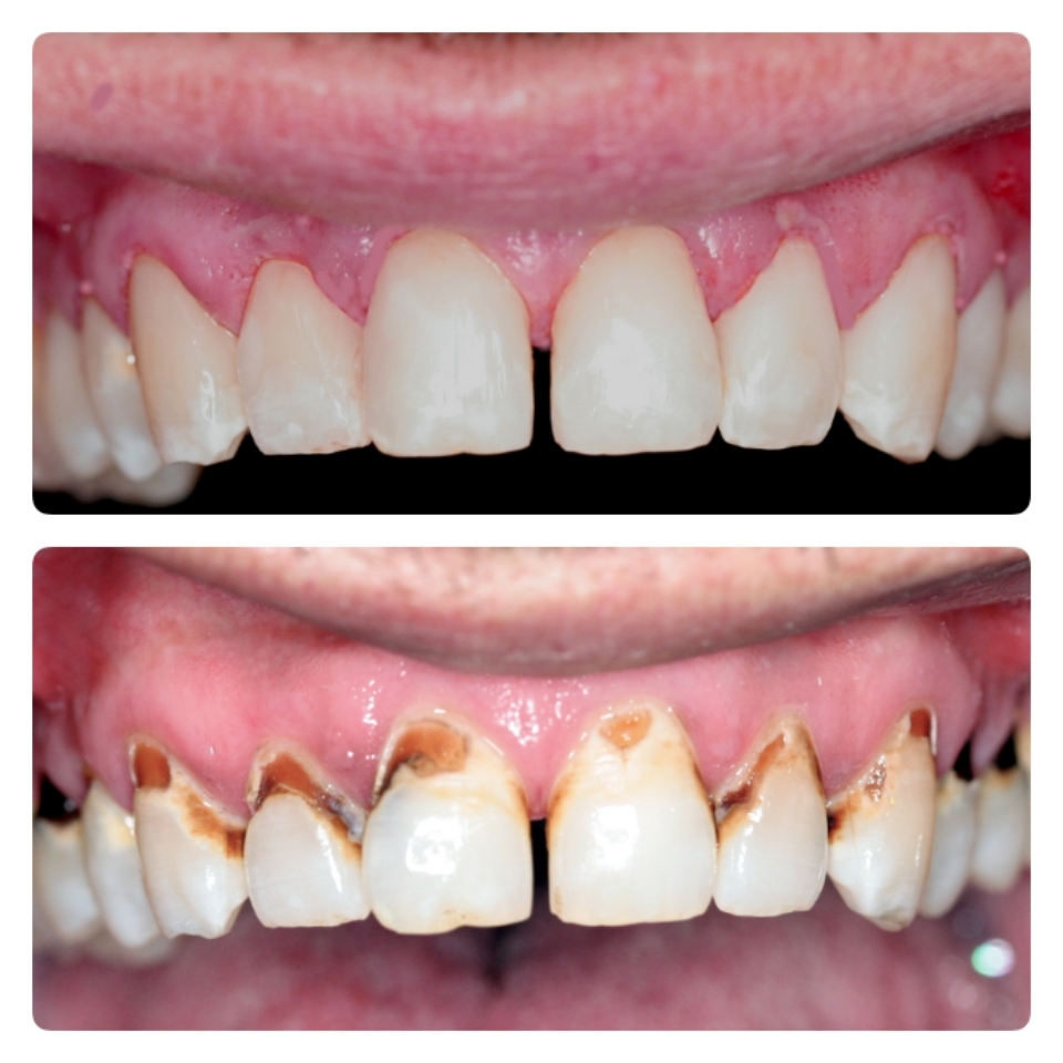 Oakwood Smiles - Dr. Sergey Gritsiv photo 2
