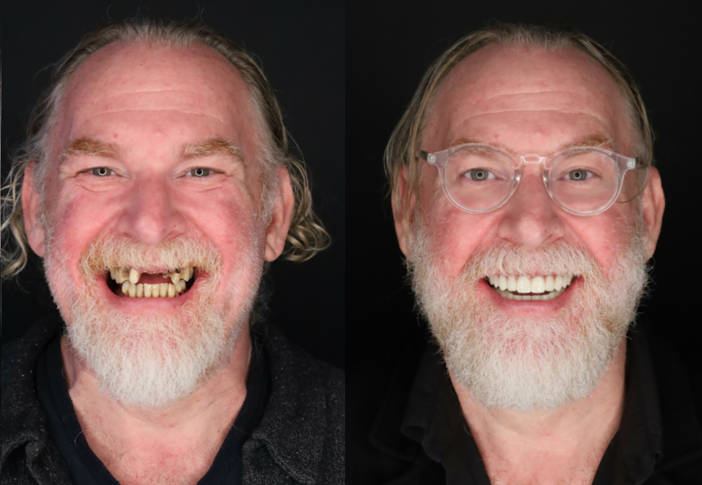 Smiles by Design - Rejuvenating Implant Dentistry photo 1