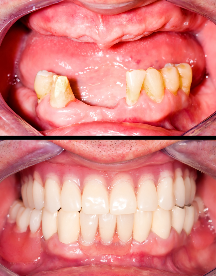 Ohio Implants and Dentures photo 2