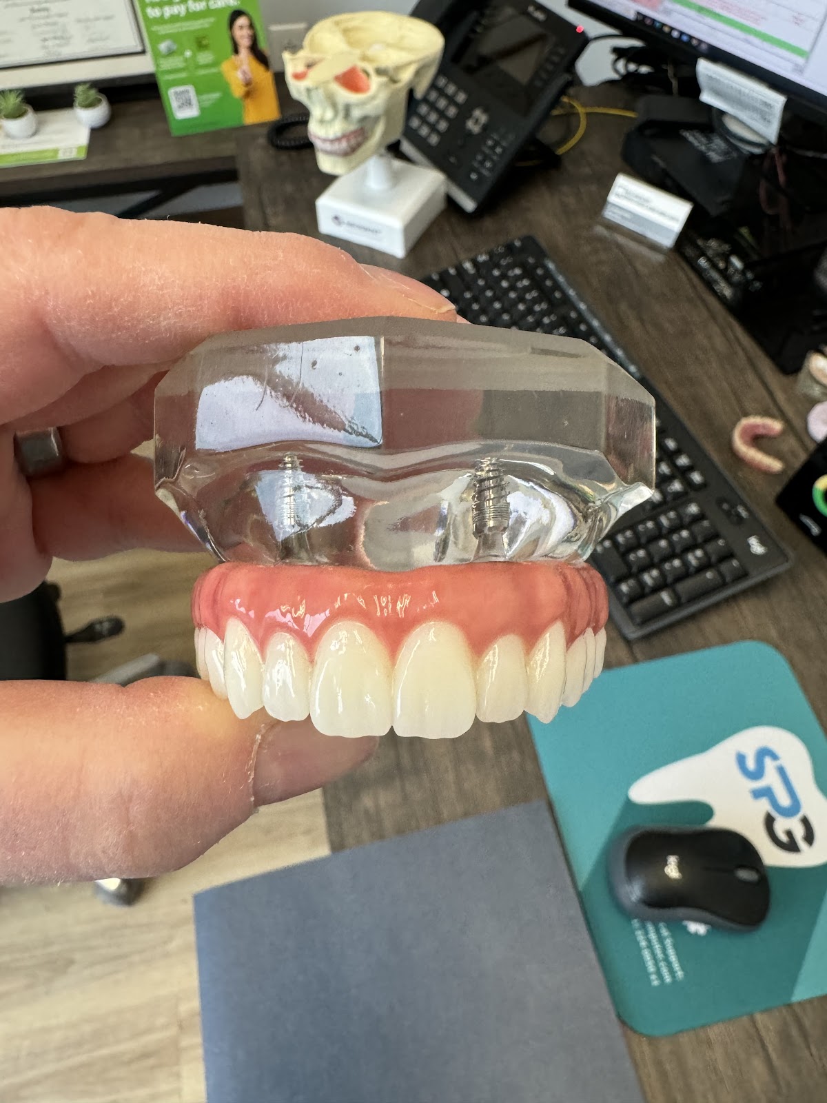 Richmond Dentures and Implants photo 6