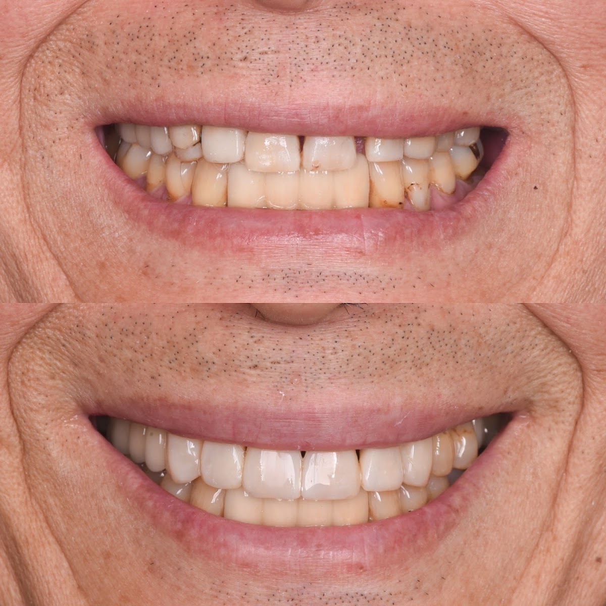 Jp Dental Hartford photo 1