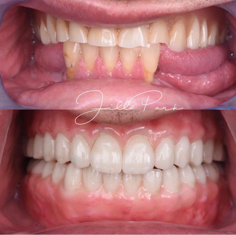 Jp Dental Hartford photo 2