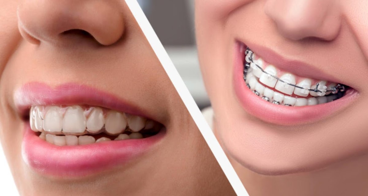 Shreveport Bossier Family Dental Care photo 1