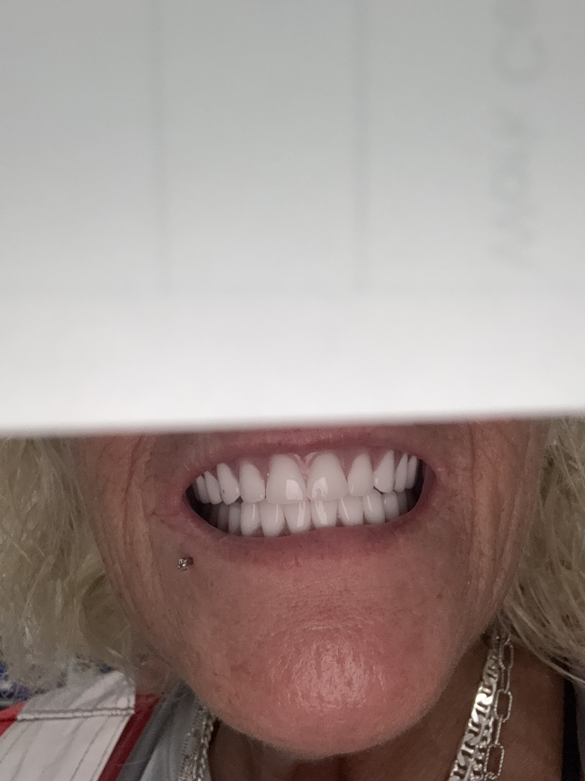 Affordable Dentures & Implants - Sanford photo 5