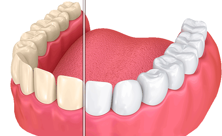 Sunrise Dental Mount Vernon photo 3