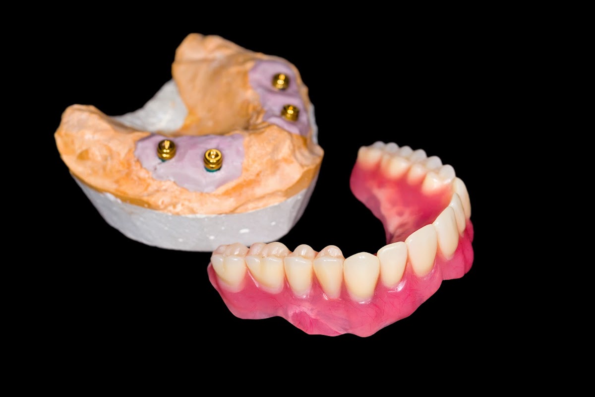 Hartman Dentistry photo 5