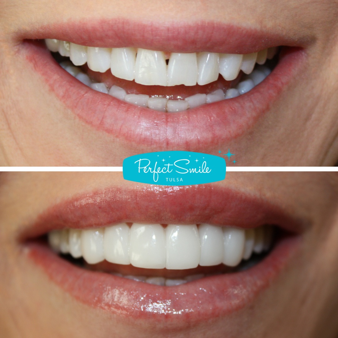 Perfect Smile Tulsa - Dentist in Tulsa, Ok photo 4