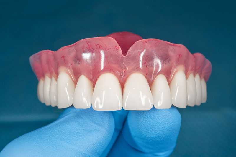Best Value Dentures and Implants Palmetto Bay photo 1