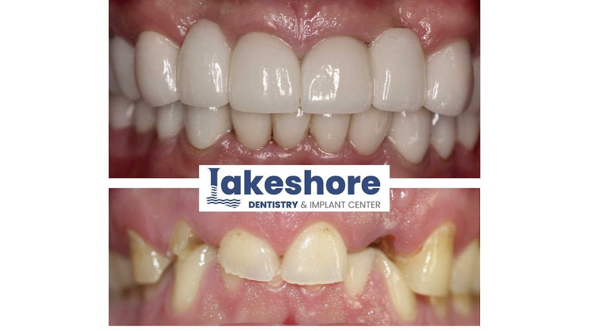 Lakeshore Dentistry & Implant Center photo 1