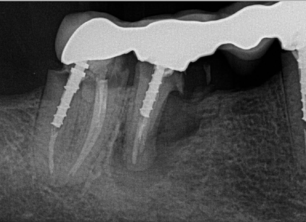 Lakeshore Dentistry & Implant Center photo 5