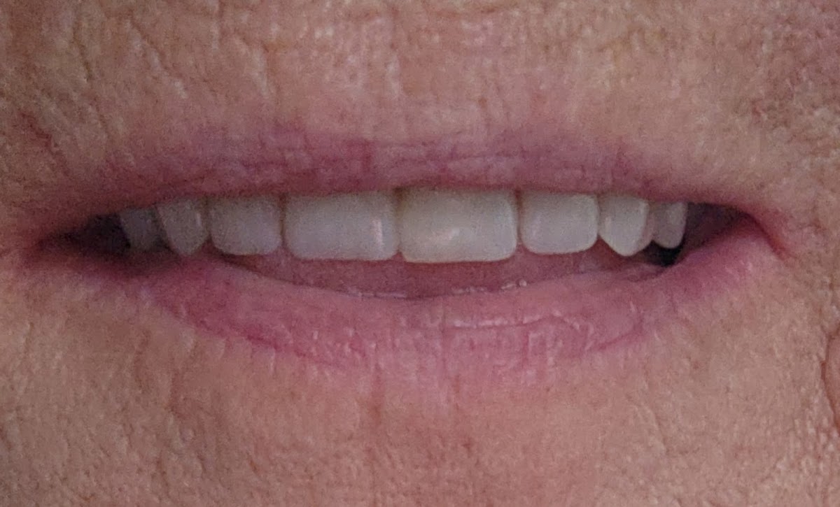 Clearchoice Dental Implant Center - Woburn photo 3
