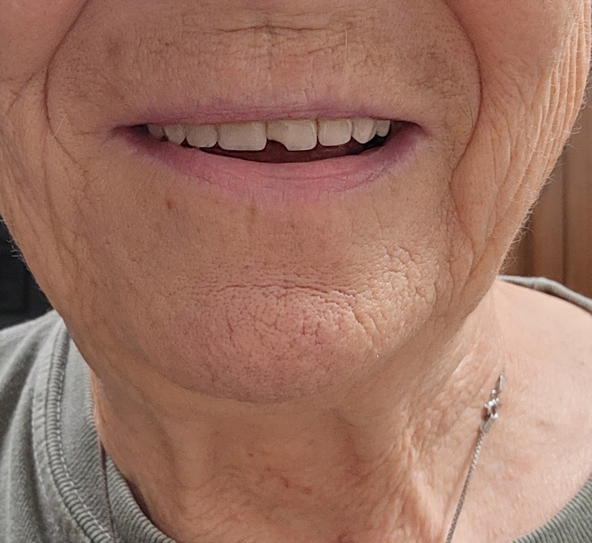 Clearchoice Dental Implant Center - Woburn photo 4