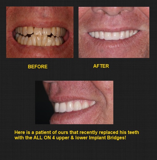 Harlingen Dental Implants photo 6