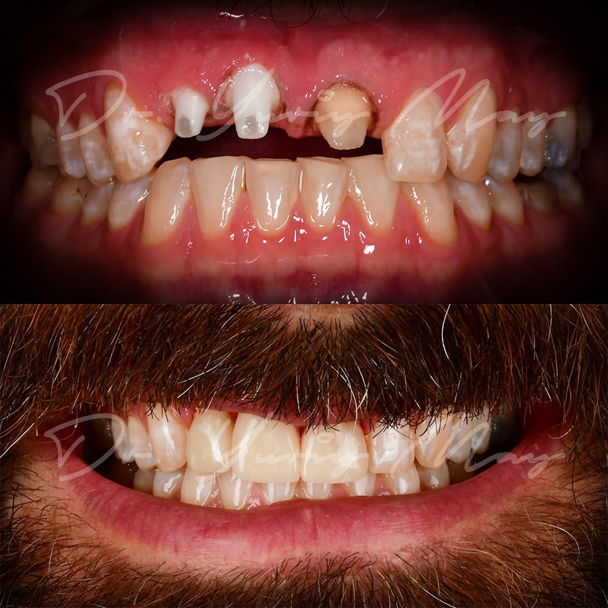 Natural Dentistry | Dr. Yuriy May | Ceramic Implant Dentistry photo 4