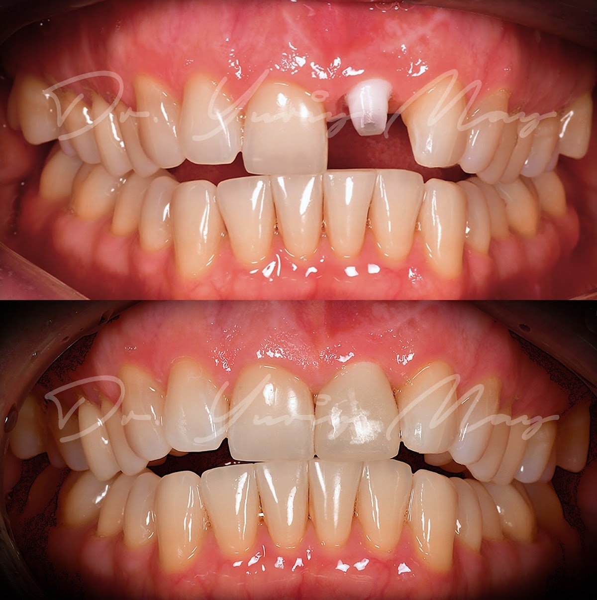 Natural Dentistry | Dr. Yuriy May | Ceramic Implant Dentistry photo 5