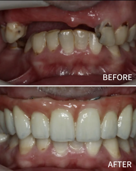 Nusmile Implant Studio photo 1
