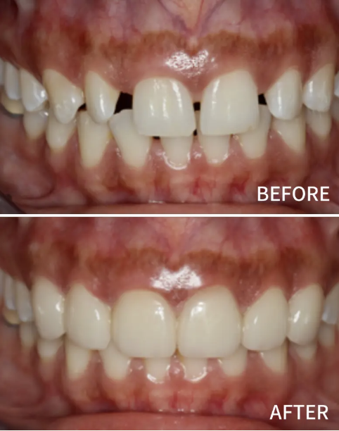 Nusmile Implant Studio photo 3