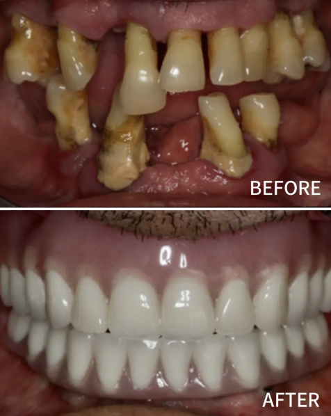 Nusmile Implant Studio photo 4