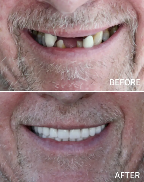 Nusmile Implant Studio photo 5