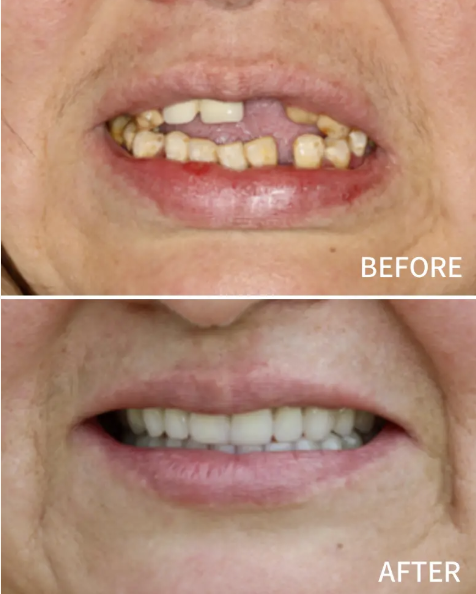 Nusmile Implant Studio photo 6