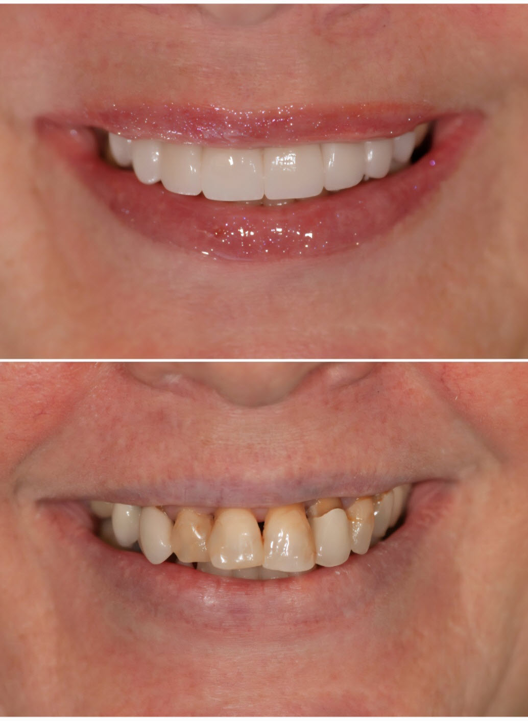 Advanced Cosmetic & Implant Dentistry photo 2
