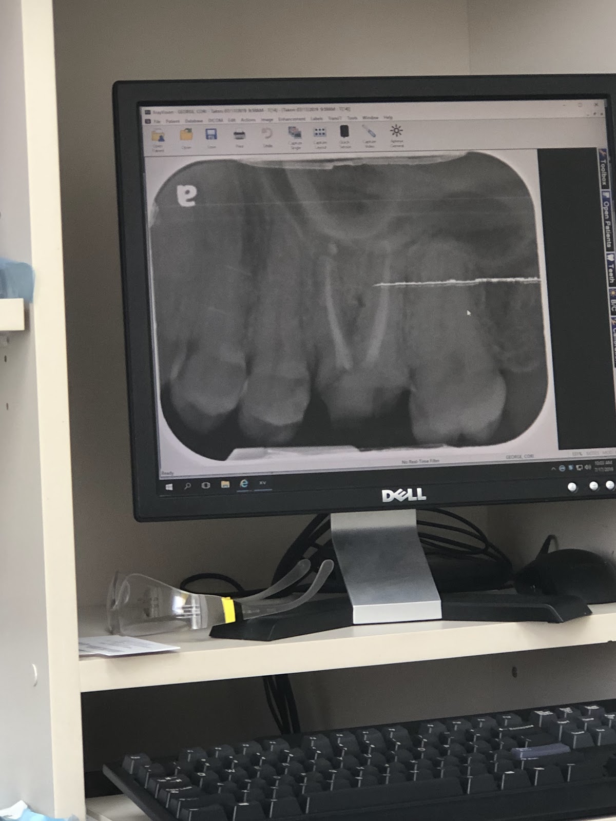 Aspen Dental - Merritt Island photo 4