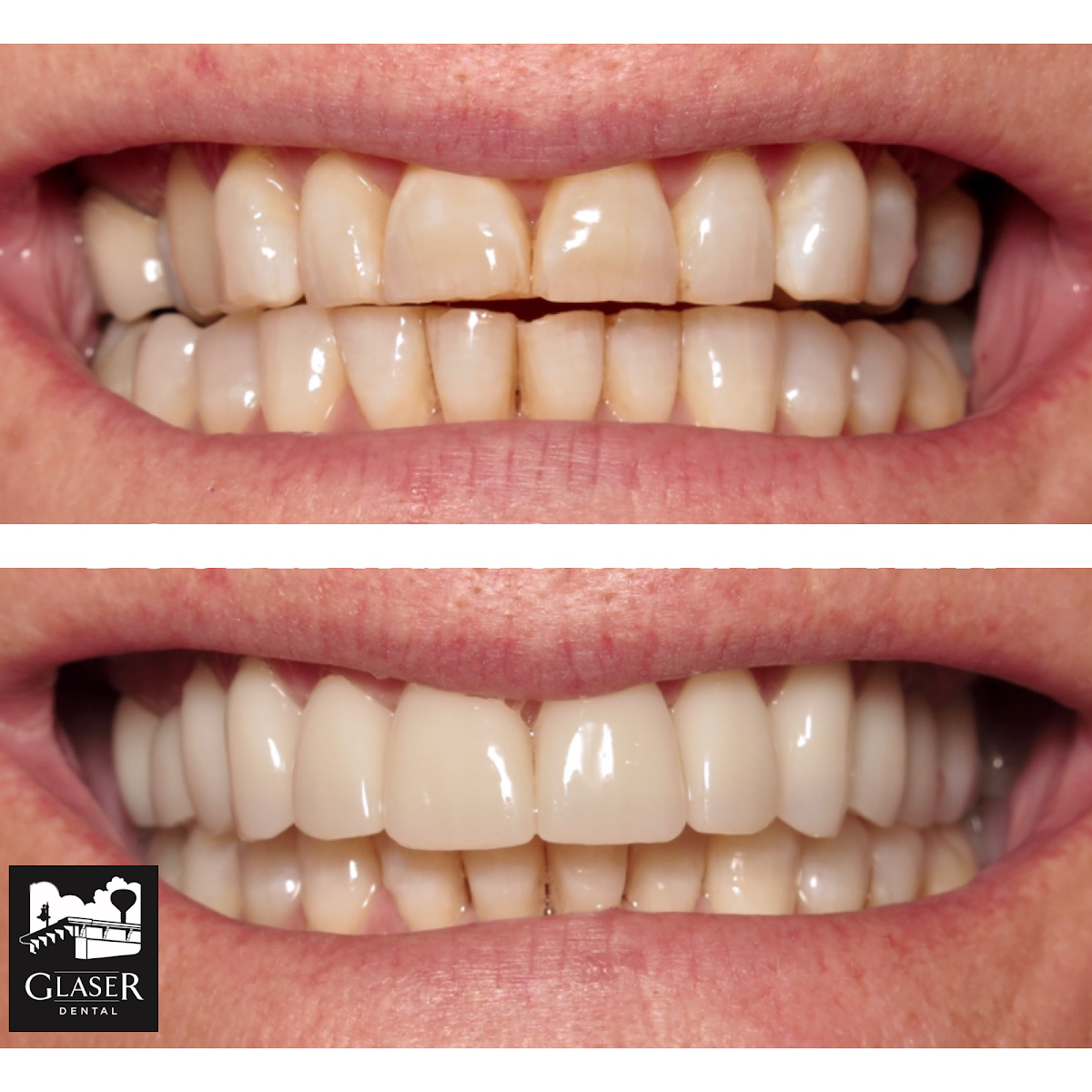 Glaser Dental photo 3