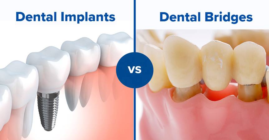 Implant And Periodontal Dentistry photo 4