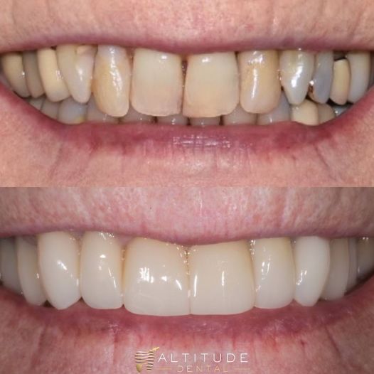 Altitude Dental - Vero Beach photo 5