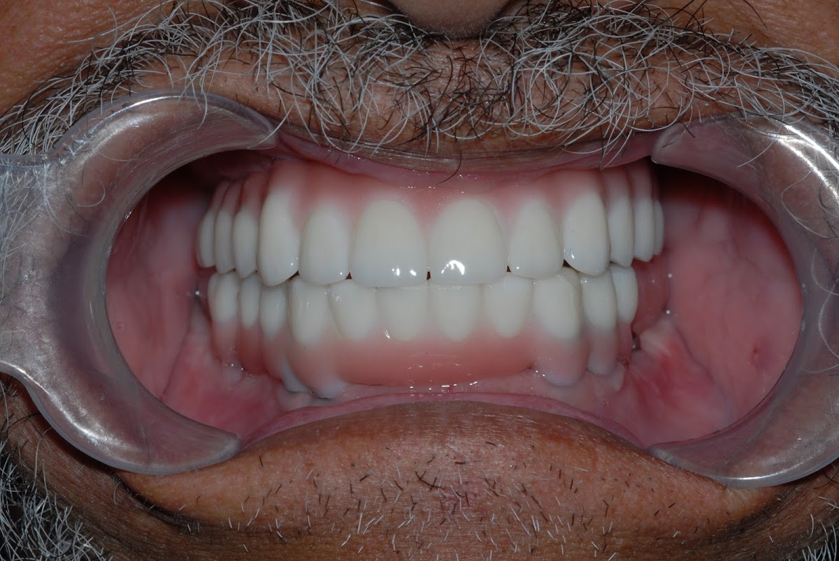 Dr. James J. Khazian, D.M.D. | Dental Implant Centers photo 2