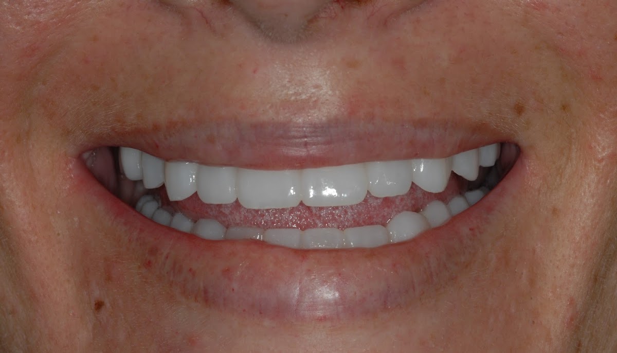 Dr. James J. Khazian, D.M.D. | Dental Implant Centers photo 6