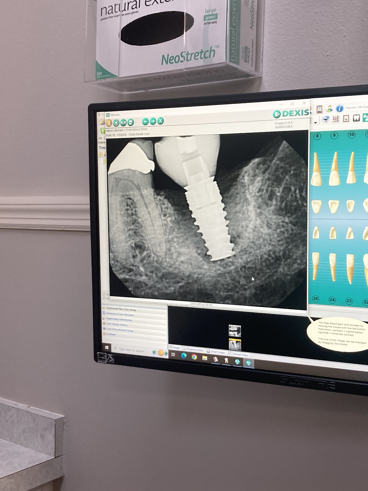 Ocala Dental Care photo 4