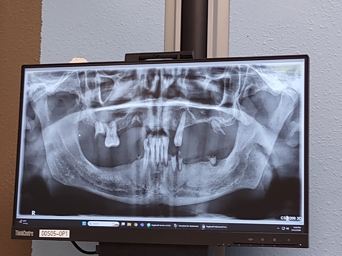 Affordable Dentures & Implants - Checotah photo 3